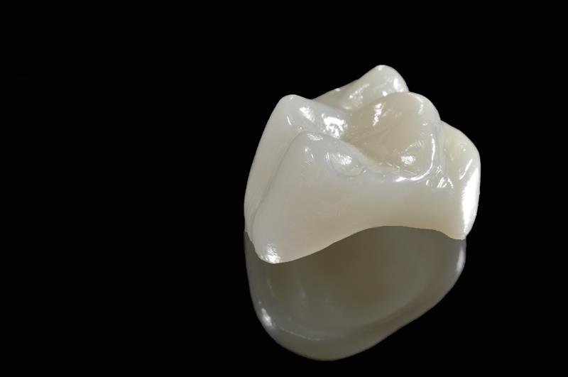 Porcelain Crowns  San Diego, CA , 
